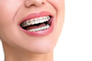 Braces & Orthodontic Correction